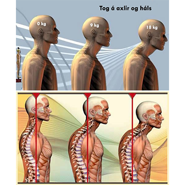Tog á axlir og háls