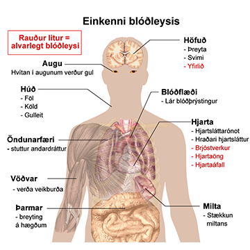 Einkenni blóðleysis